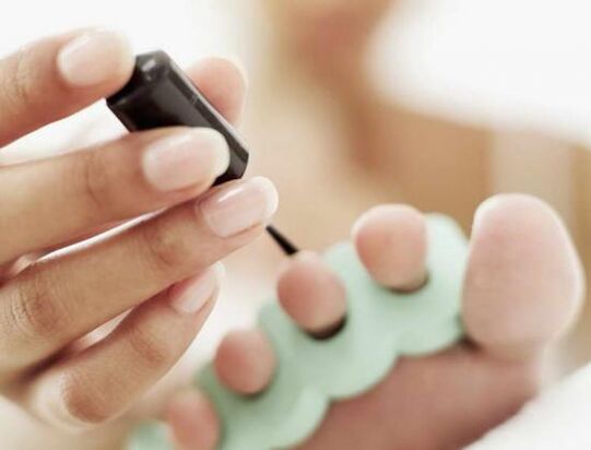 tretiranje noktiju lakom za nokte od gljivične infekcije