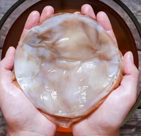 gljivice noktiju kombucha